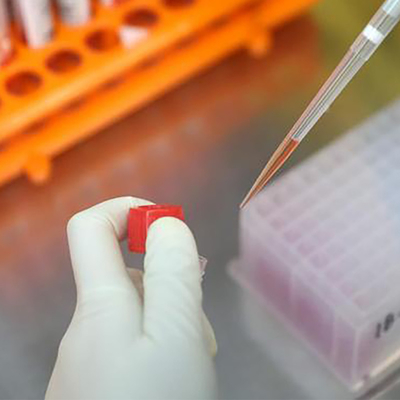 RT PCR 테스트 키트 Monkeypox 바이러스 MPXV CE 등록 1 테스트/박스